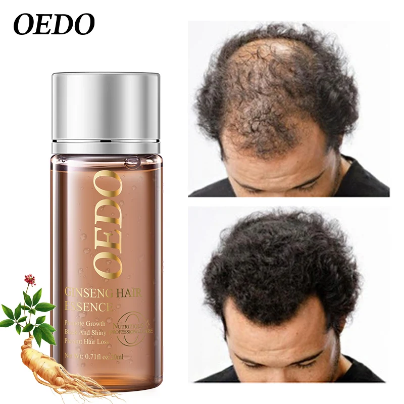 Ginseng Hair Regenerating Serum Prevents Hair Loss Repairs Dry Damage Increases Strength Softens Hair Nutritious Hair Oil
Ginseng Hair Regenerating Serum Prevents Hair Loss Repairs Dry Damage Increases Strength Softens Hair Nutritious Hair Oil