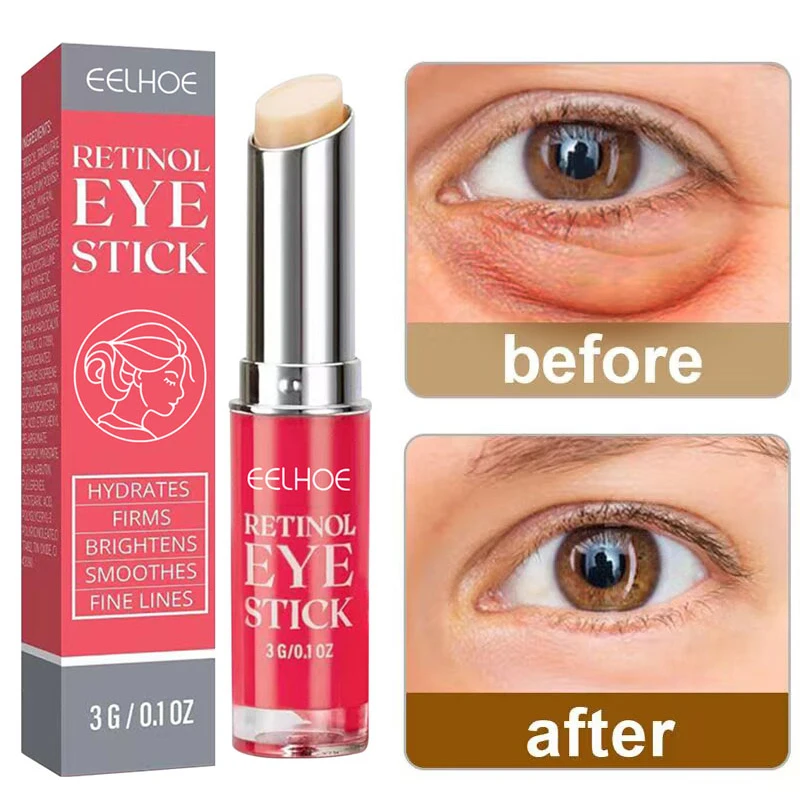 Retinol Anti-Wrinkle Eye Cream Stick Get Rid Of Eye Puffs Lift Eye Area Whitening Moisturizing Repairing Eye Treatment New
Retinol Anti-Wrinkle Eye Cream Stick Get Rid Of Eye Puffs Lift Eye Area Whitening Moisturizing Repairing Eye Treatment New
