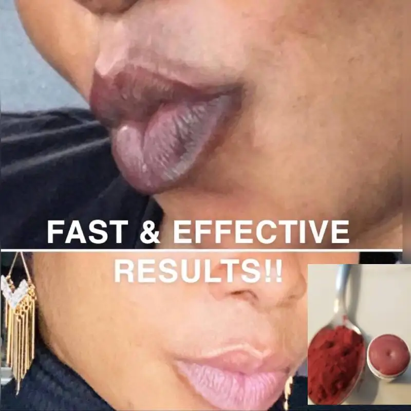 EXTREME Pink Lip Lightening Cream Solution - Dark Lip Corrector, Permanent Pink Lips, Smokers Lip Cream, Dark Lips Cream
EXTREME Pink Lip Lightening Cream Solution - Dark Lip Corrector, Permanent Pink Lips, Smokers Lip Cream, Dark Lips Cream