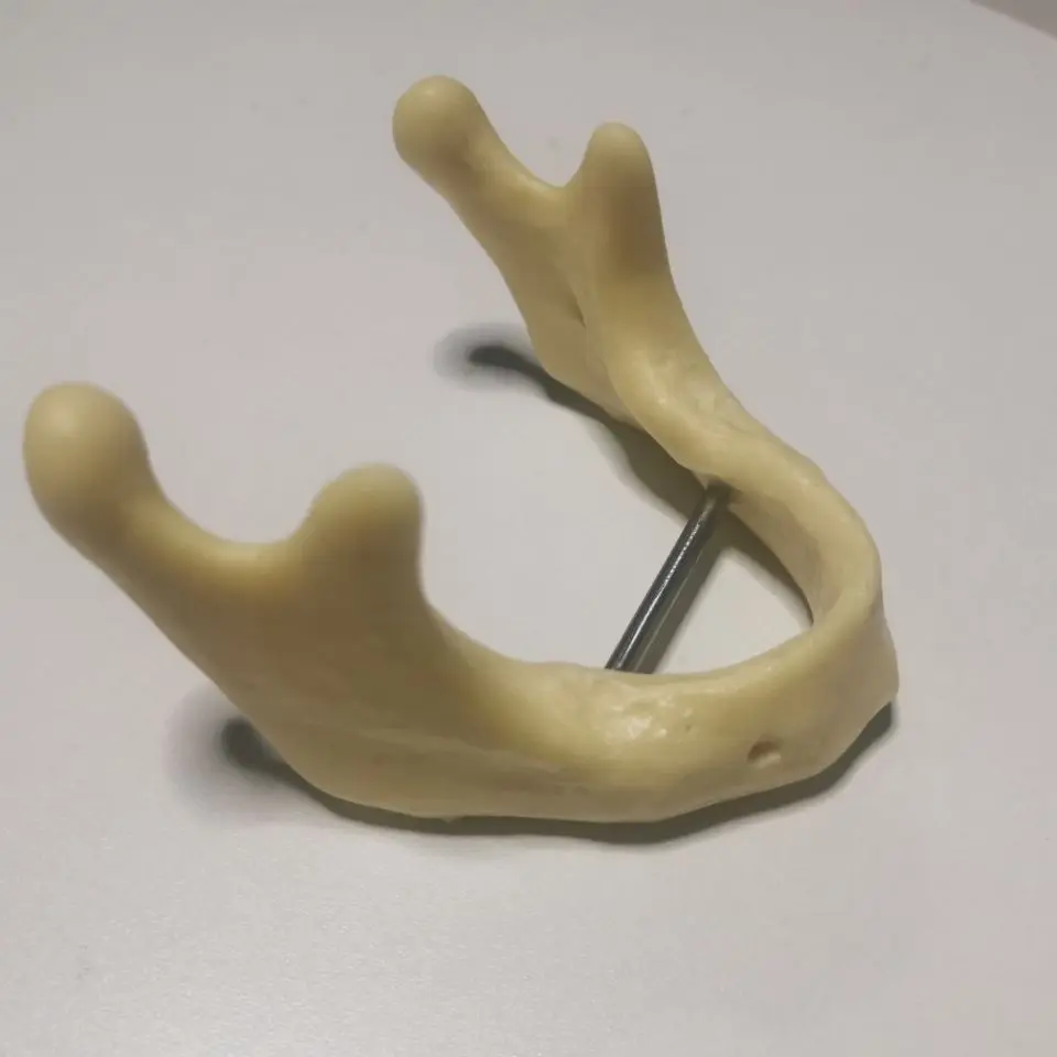 Стоматология Mandible для тренировки имплантации модель бурения Стоматологическая для тренировки имплантации модель
Стоматология Mandible для тренировки имплантации модель бурения Стоматологическая для тренировки имплантации модель