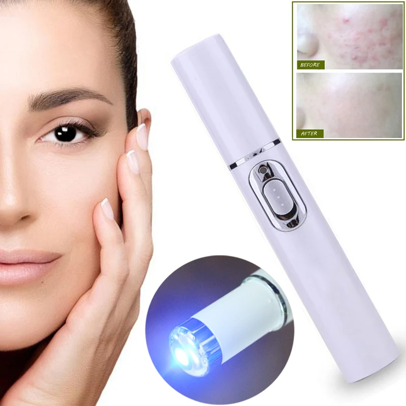 Acne Laser Pen Portable Wrinkle Removal Machine Durable Blue Light Therapy Massage Relax Soft Scar Dark Circles Remover Device
Acne Laser Pen Portable Wrinkle Removal Machine Durable Blue Light Therapy Massage Relax Soft Scar Dark Circles Remover Device