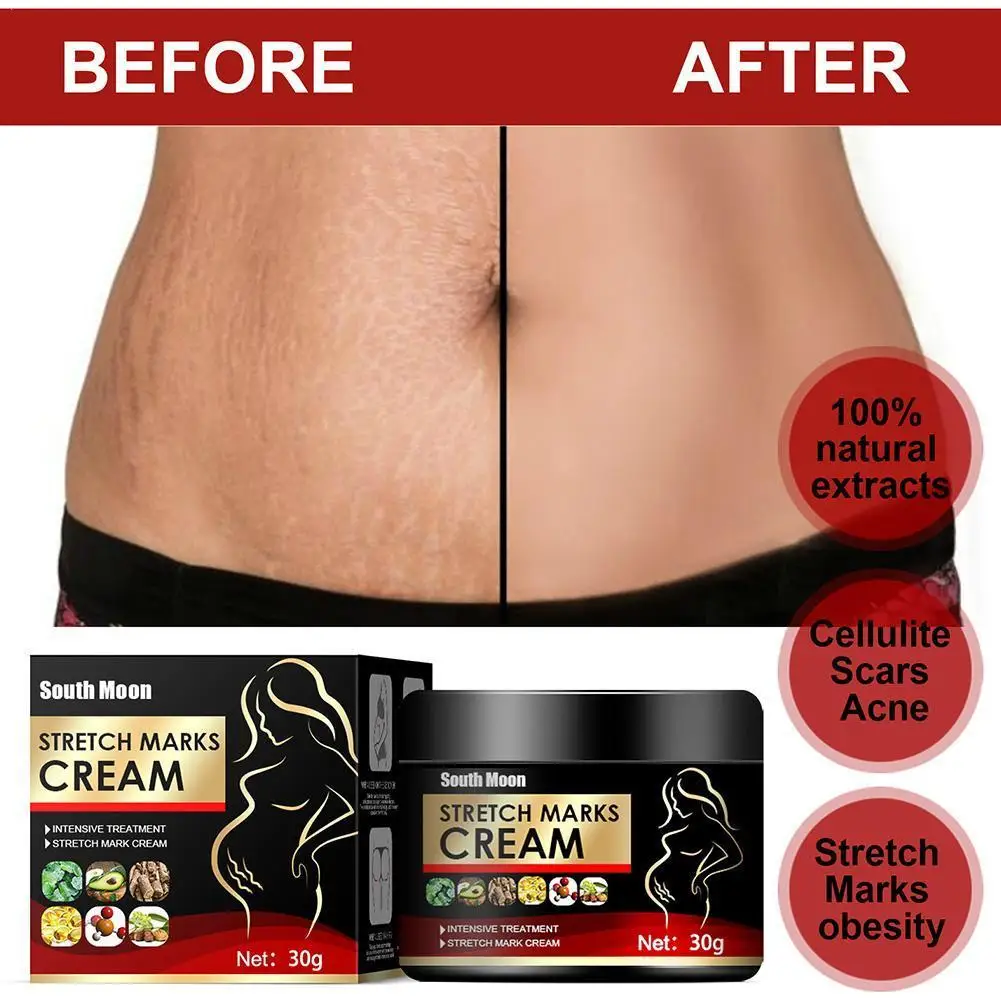 Pregnancy Repair Cream Stretch Mark Removal Removal Acne Scar Stretch Marks Cream Fat Striae Gravidarum Treatment Body Creams
Pregnancy Repair Cream Stretch Mark Removal Removal Acne Scar Stretch Marks Cream Fat Striae Gravidarum Treatment Body Creams