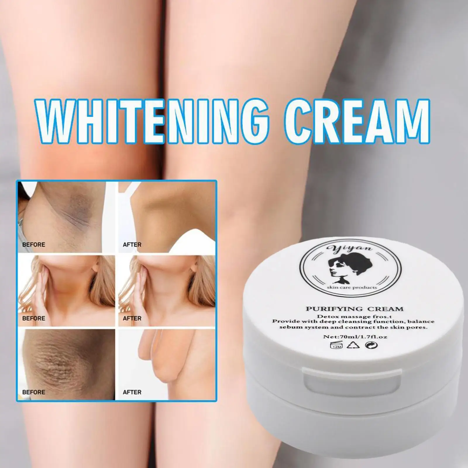 Remove Melanin Pigmentation Fast Whitening Cream For Private Parts Knuckle Elbows Stains Remover Serum Anti Acanthosis Nigr O7E5
Remove Melanin Pigmentation Fast Whitening Cream For Private Parts Knuckle Elbows Stains Remover Serum Anti Acanthosis Nigr O7E5