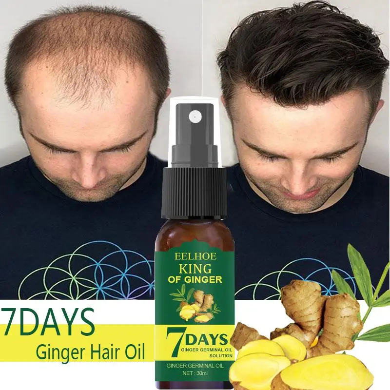 Ginger Hair Growth Essential Oil Fast Growing Hair Regrowth Serum Natural Anti Hair Loss Spray Hair Thinning Treatment Products
Ginger Hair Growth Essential Oil Fast Growing Hair Regrowth Serum Natural Anti Hair Loss Spray Hair Thinning Treatment Products