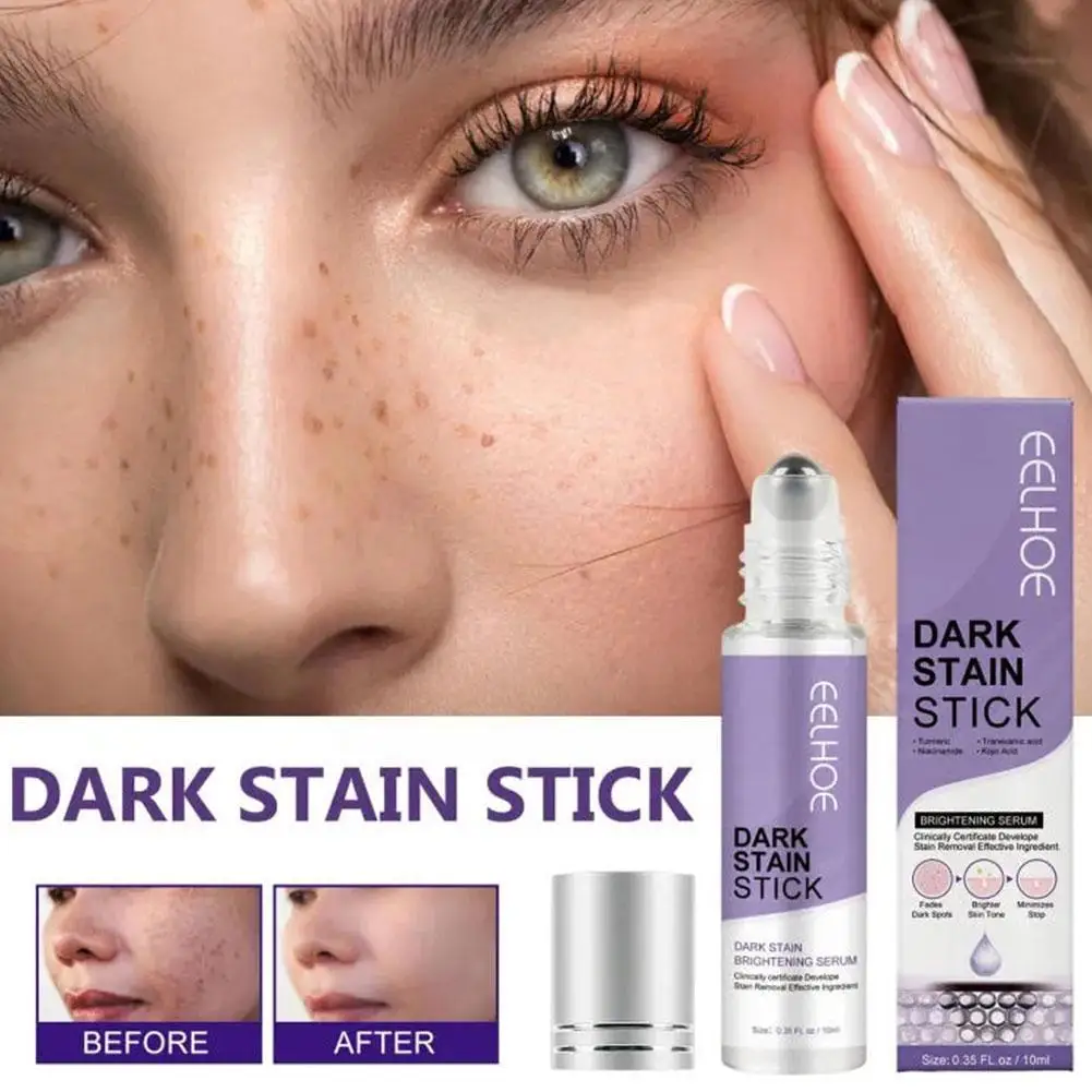 Anti Dark Circle Eye Cream Peptide Anti Wrinkle Anit Aging Spot Korean Acid Dark Remover Facial Hyaluronic Care Skin Serum W7V4
Anti Dark Circle Eye Cream Peptide Anti Wrinkle Anit Aging Spot Korean Acid Dark Remover Facial Hyaluronic Care Skin Serum W7V4