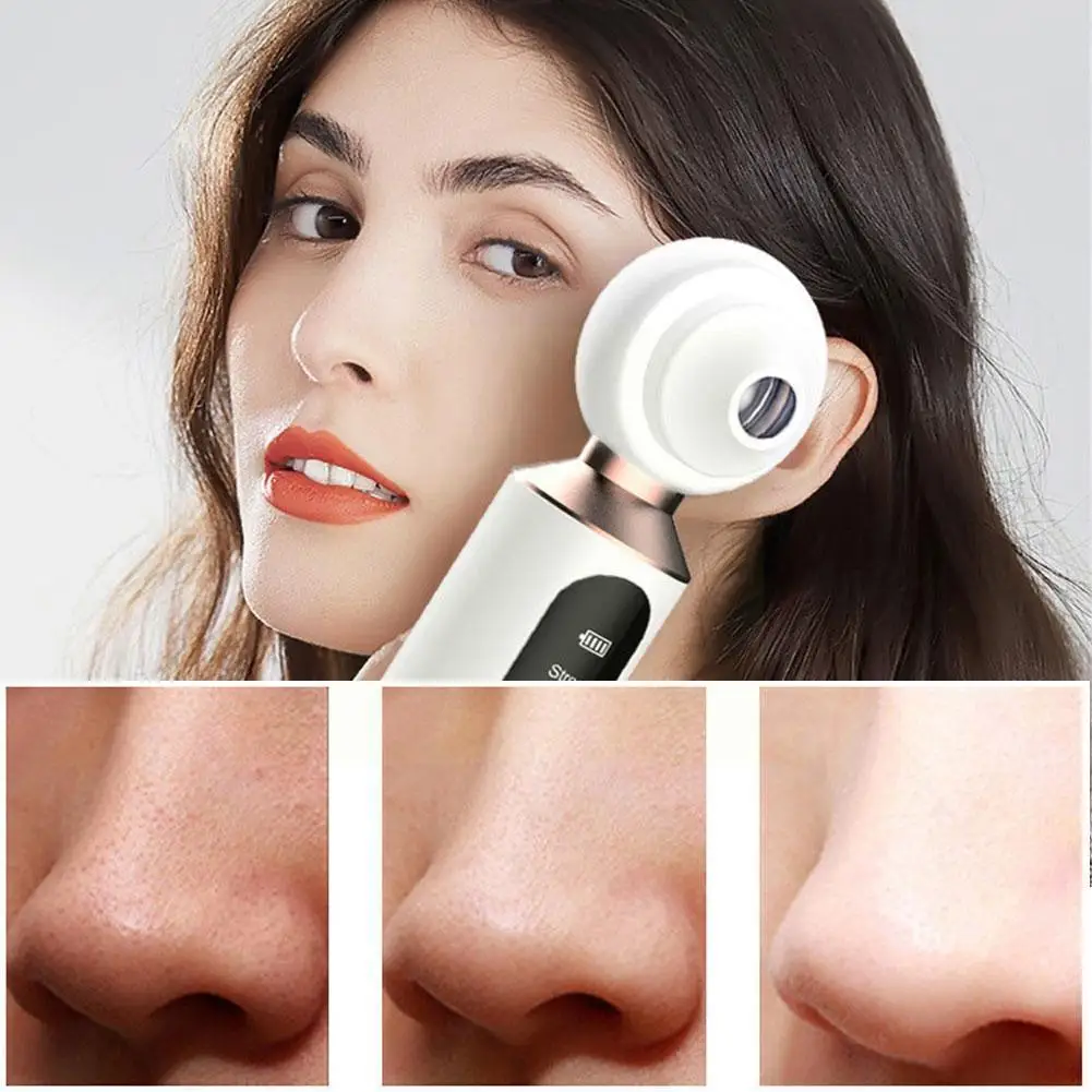 Visual Blackhead Meter Household Pore Cleaner Blue Washing Sucking Meter Blackhead Face And Light Electric Cleansing New M5a4
Visual Blackhead Meter Household Pore Cleaner Blue Washing Sucking Meter Blackhead Face And Light Electric Cleansing New M5a4