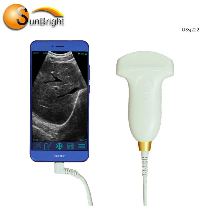 Mini Handheld ecografo USB convex Ultrasound Probe For Laptop, Pocket Ultrasound Device
Mini Handheld ecografo USB convex Ultrasound Probe For Laptop, Pocket Ultrasound Device