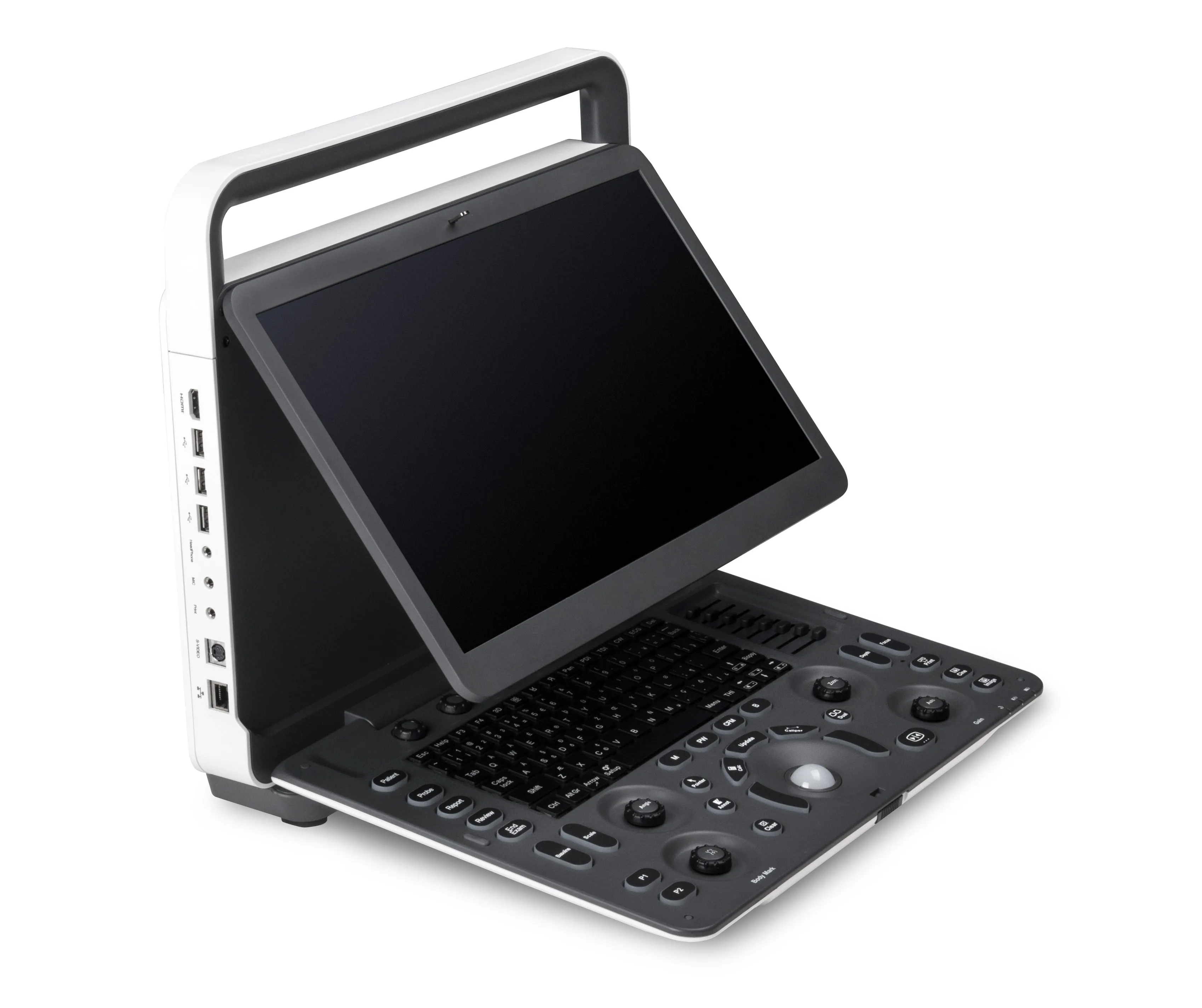 Sonoscape E2 ultrasound scanner for vascular
Sonoscape E2 ultrasound scanner for vascular