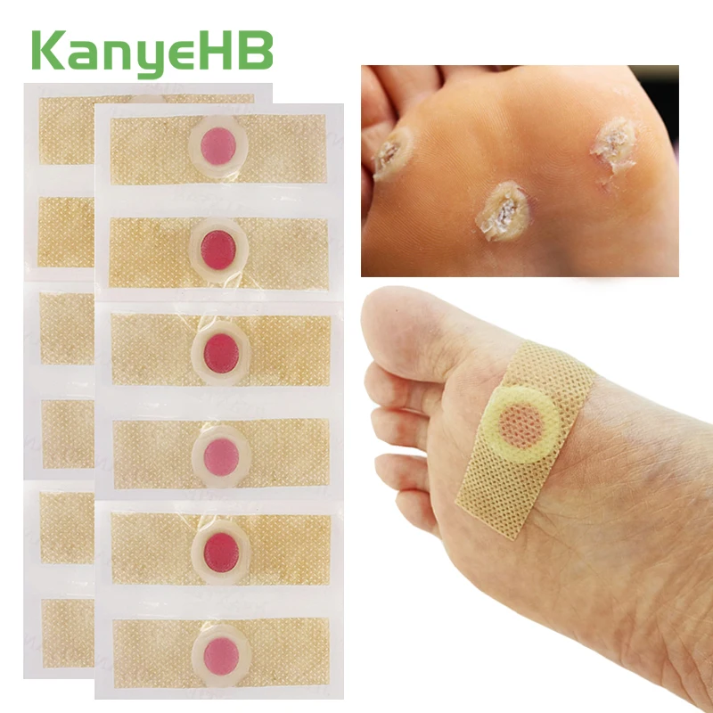 12Pcs Foot Care Medical Plaster Feet Corn Remover Warts Thorn Patch Calluses Skin Tag Removal Patch Soften Skin Cutin Pads A172
12Pcs Foot Care Medical Plaster Feet Corn Remover Warts Thorn Patch Calluses Skin Tag Removal Patch Soften Skin Cutin Pads A172