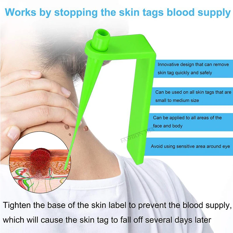 Blue Set Skin Tag Removal Kit Home Use To Medium Face Care Blue Micro Band with Cleansing Tool Easy To Clean Skin Care Tool
Blue Set Skin Tag Removal Kit Home Use To Medium Face Care Blue Micro Band with Cleansing Tool Easy To Clean Skin Care Tool