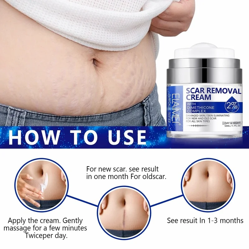 Maternity Scars Acne Cream Pregnancy Stretch Marks Remove Cream 7 Day Effect ESSENTI Skin Care Repair Anti-White Stretch 50ML
Maternity Scars Acne Cream Pregnancy Stretch Marks Remove Cream 7 Day Effect ESSENTI Skin Care Repair Anti-White Stretch 50ML