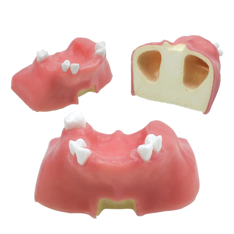 Модель зубного импланта, стоматологический инструмент, стоматологический инструмент 
Модель зубного импланта, стоматологический инструмент, стоматологический инструмент