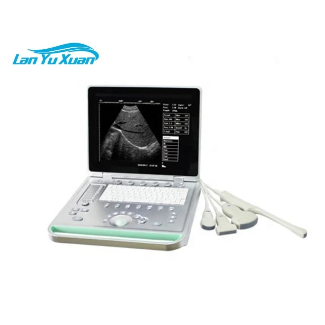 Portable Ultrasound Cavitation Machine 2 Prob 3d 4d 5d Color Doppler Ultrasound Machine Laptop Ultrasound Scanner
Portable Ultrasound Cavitation Machine 2 Prob 3d 4d 5d Color Doppler Ultrasound Machine Laptop Ultrasound Scanner