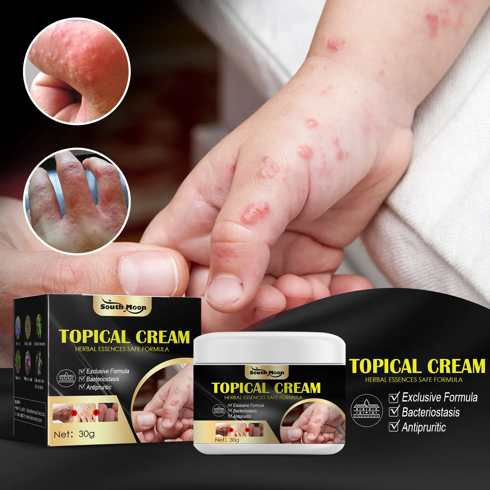 Herb Antibacterial Itching Cream Anti Mosquito Insect Bites Dermatitis Eczema Psoriasis Treatment Antipruritic Relief Skin Care
Herb Antibacterial Itching Cream Anti Mosquito Insect Bites Dermatitis Eczema Psoriasis Treatment Antipruritic Relief Skin Care
