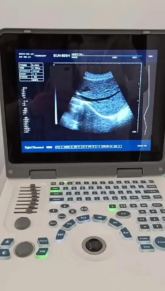 Promotion Echographe Portable Laptop Ultrasound Scan Machine Ce Electricity Li-ion Rechargeable Battery; AC Supply 12.1 Inch LED
Promotion Echographe Portable Laptop Ultrasound Scan Machine Ce Electricity Li-ion Rechargeable Battery; AC Supply 12.1 Inch LED