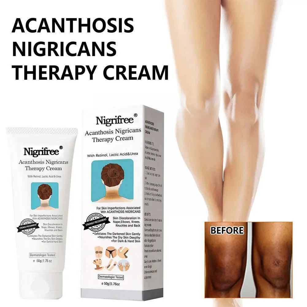 50ml Black Spine Skin Repair Cream for Underarm Arm Knee Joint Black Moisturizing Whitening Body Care Cream V3N3
50ml Black Spine Skin Repair Cream for Underarm Arm Knee Joint Black Moisturizing Whitening Body Care Cream V3N3