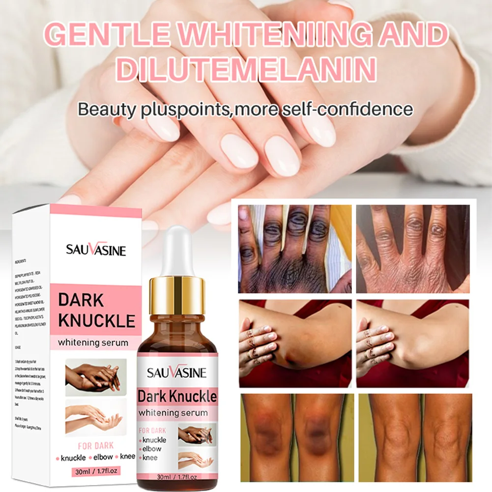 Dark Knuckle Whitening Serum Lighten Melanin Reduce Knee Elbow Dullness Skin Brightening Bleaching Essence Skin Care
Dark Knuckle Whitening Serum Lighten Melanin Reduce Knee Elbow Dullness Skin Brightening Bleaching Essence Skin Care