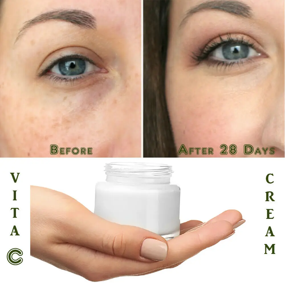 Matrixyl 3000 Peptide Hyaluronic Acid Retinol Collagen AntiAging Vitamin C Cream
Matrixyl 3000 Peptide Hyaluronic Acid Retinol Collagen AntiAging Vitamin C Cream