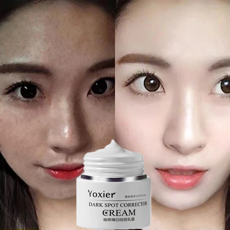 Dark Spot Correction Cream Remove Spots Body Pigmentation Face Cream Uneven Skin Tone Whitening Brightening Skin Care 30g
Dark Spot Correction Cream Remove Spots Body Pigmentation Face Cream Uneven Skin Tone Whitening Brightening Skin Care 30g