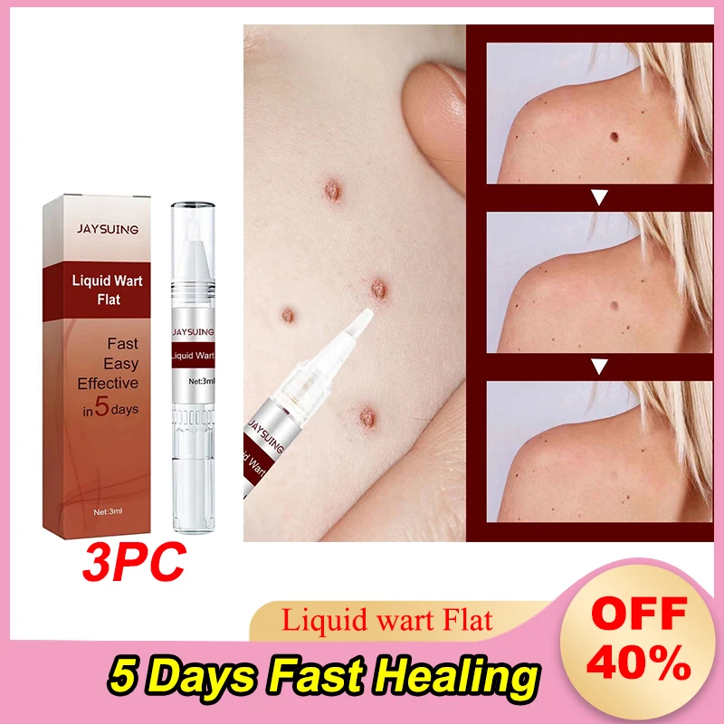 3pcs Warts Remover Liquid Skin Tag Remover Antibacterial Ointment Wart Herbal Treatment Cream Safe Beauty Skin Care Products
3pcs Warts Remover Liquid Skin Tag Remover Antibacterial Ointment Wart Herbal Treatment Cream Safe Beauty Skin Care Products