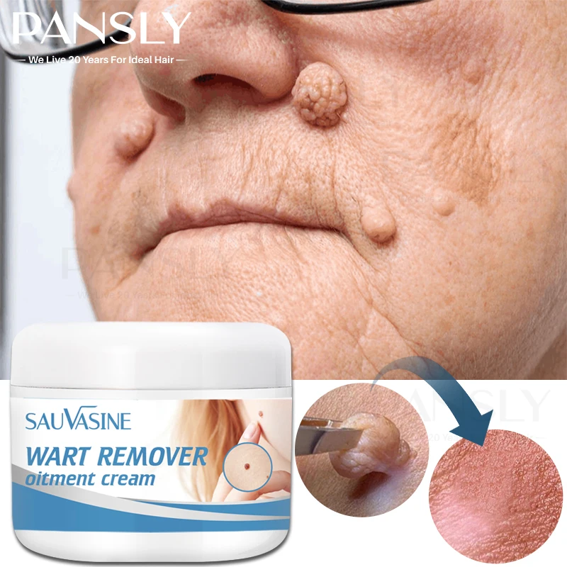 PANSLY Wart Remover Cream Painless Treatment of The Skin of The Neck Armpits Genitals and Flat Warts Calluses of The Feet Cream
PANSLY Wart Remover Cream Painless Treatment of The Skin of The Neck Armpits Genitals and Flat Warts Calluses of The Feet Cream