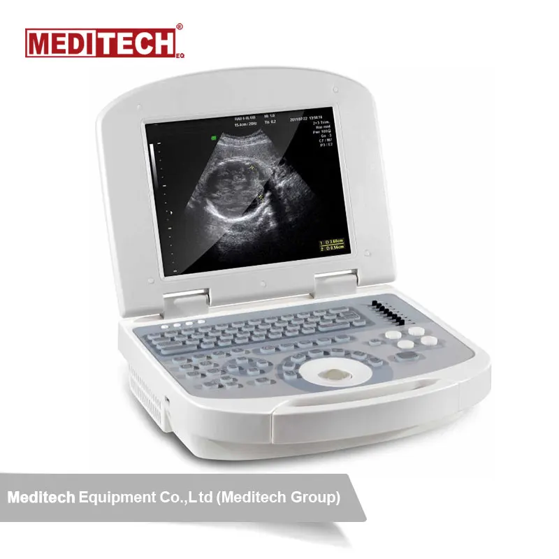 Meditech Siterite Vasular Ultrasound Laptop 2D B/W Clear Image Ultrasound Machine with Convex probe CE supported
Meditech Siterite Vasular Ultrasound Laptop 2D B/W Clear Image Ultrasound Machine with Convex probe CE supported