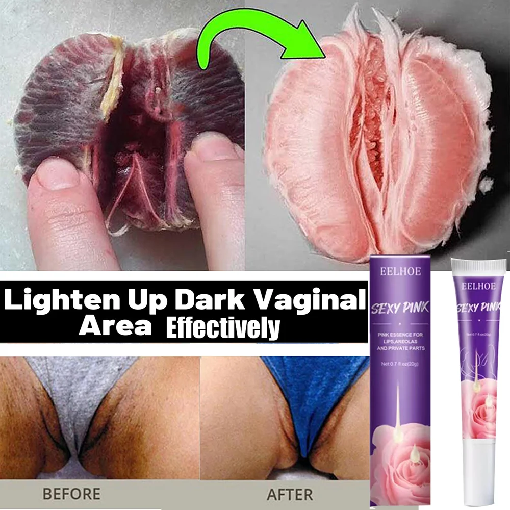 Whitening Cream Private Parts Underarm Bleaching Serum Whiten Butt Knee Brighten Inner Thigh Intimate Parts Dark Remove Melanin
Whitening Cream Private Parts Underarm Bleaching Serum Whiten Butt Knee Brighten Inner Thigh Intimate Parts Dark Remove Melanin