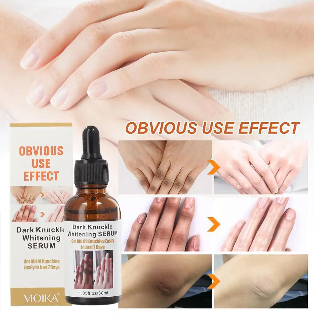 30ml Unisex Whitening Moisturizing Serum Hand Knuckle Glow Serum for Removing Dark Knuckle Elbow Knee Strong Dark Knuckle S W1V7
30ml Unisex Whitening Moisturizing Serum Hand Knuckle Glow Serum for Removing Dark Knuckle Elbow Knee Strong Dark Knuckle S W1V7