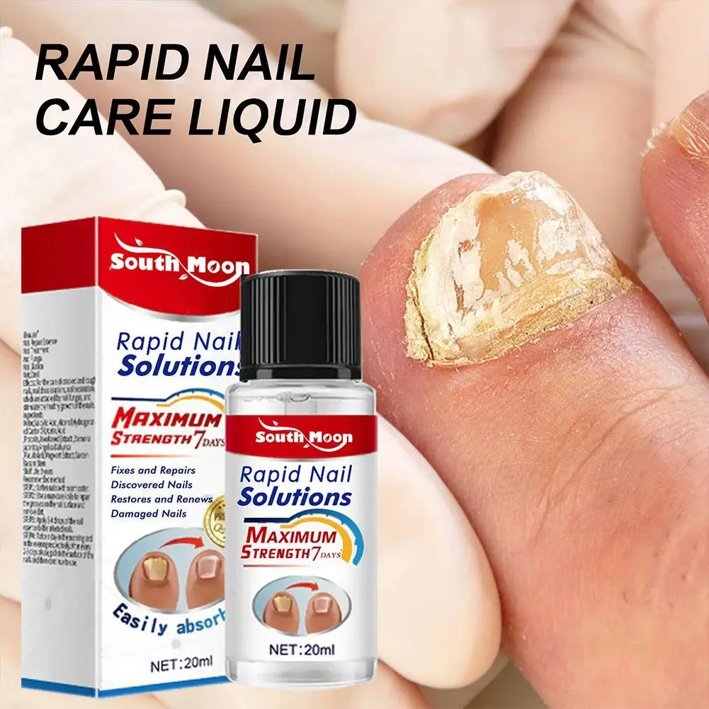 20ml Hand Foot Nail Fungal Treatment Solution Remove Cellulite Onychomycosis Antibacterial Solution Nail Care Repair Liquid
20ml Hand Foot Nail Fungal Treatment Solution Remove Cellulite Onychomycosis Antibacterial Solution Nail Care Repair Liquid