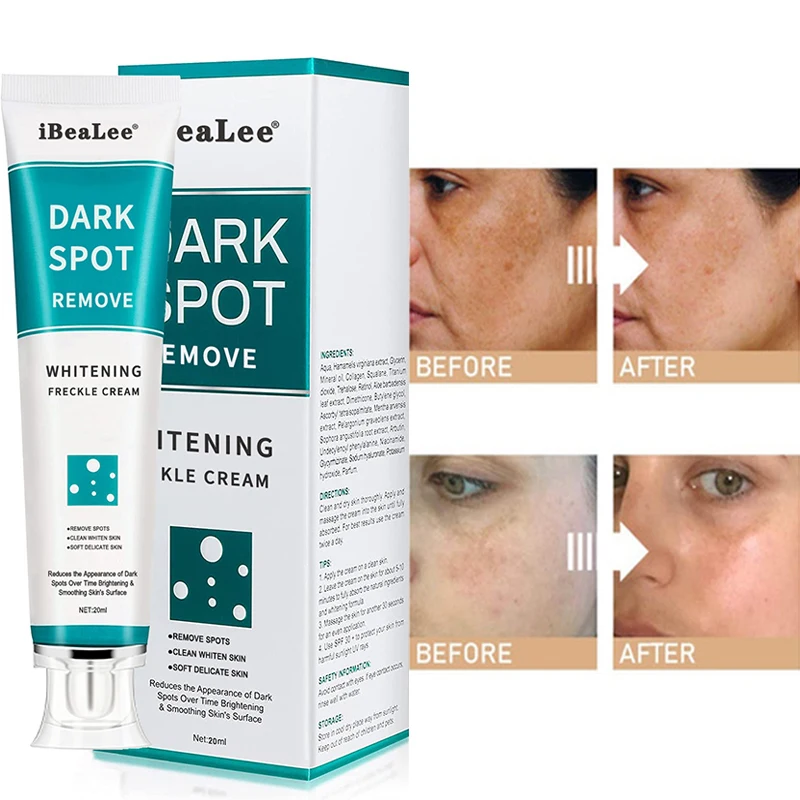 Whitening Freckle Cream Face Remove Dark Spots Melanin Melasma Remover Brightening Skin Effective Repair Anti-Aging Skin Cream
Whitening Freckle Cream Face Remove Dark Spots Melanin Melasma Remover Brightening Skin Effective Repair Anti-Aging Skin Cream