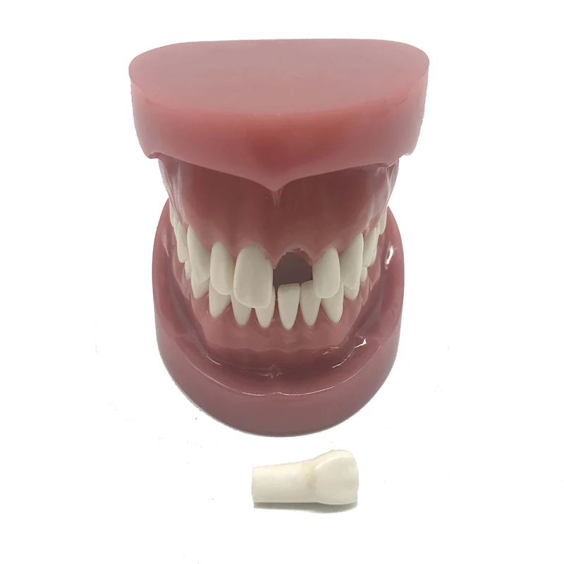 Dental Routine 1:1 Model Dental Teaching Model Exercise Tooth Extraction And Tooth Removal Soft Gum Complete Mouth Removal
Dental Routine 1:1 Model Dental Teaching Model Exercise Tooth Extraction And Tooth Removal Soft Gum Complete Mouth Removal
