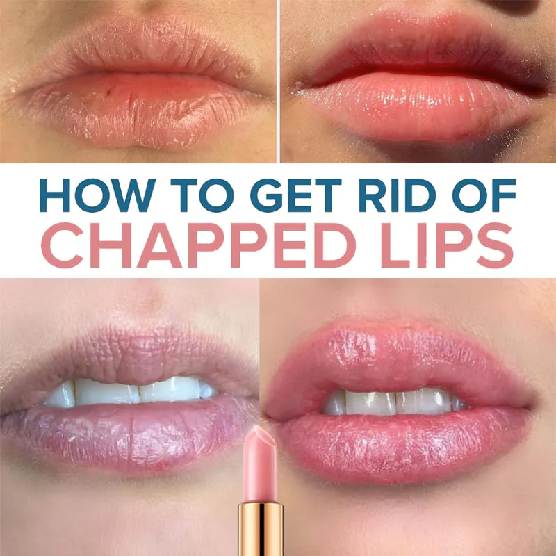 Winter Skin Care Products Moisturizing Lip Balm Lock In Moisture Get Rid of Dry Chapped Lips Vitamin C Fix Cracked Skin Smoother 
Winter Skin Care Products Moisturizing Lip Balm Lock In Moisture Get Rid of Dry Chapped Lips Vitamin C Fix Cracked Skin Smoother