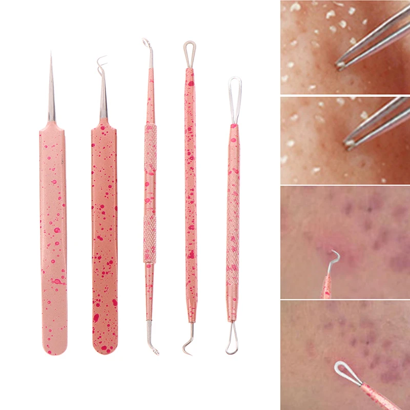 Acne Blackhead Removal Needles Black Dots Acne Remover Squeeze Deep Cleansing Facial Blackhead Eliminators Skin Care Tools
Acne Blackhead Removal Needles Black Dots Acne Remover Squeeze Deep Cleansing Facial Blackhead Eliminators Skin Care Tools