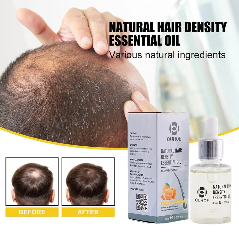 30ml Ginger Natural Hair Density Essential Oil Anti Prevent Lose Liquid Regrowth Fast Growth Serum Nutirents Beauty Health Care
30ml Ginger Natural Hair Density Essential Oil Anti Prevent Lose Liquid Regrowth Fast Growth Serum Nutirents Beauty Health Care