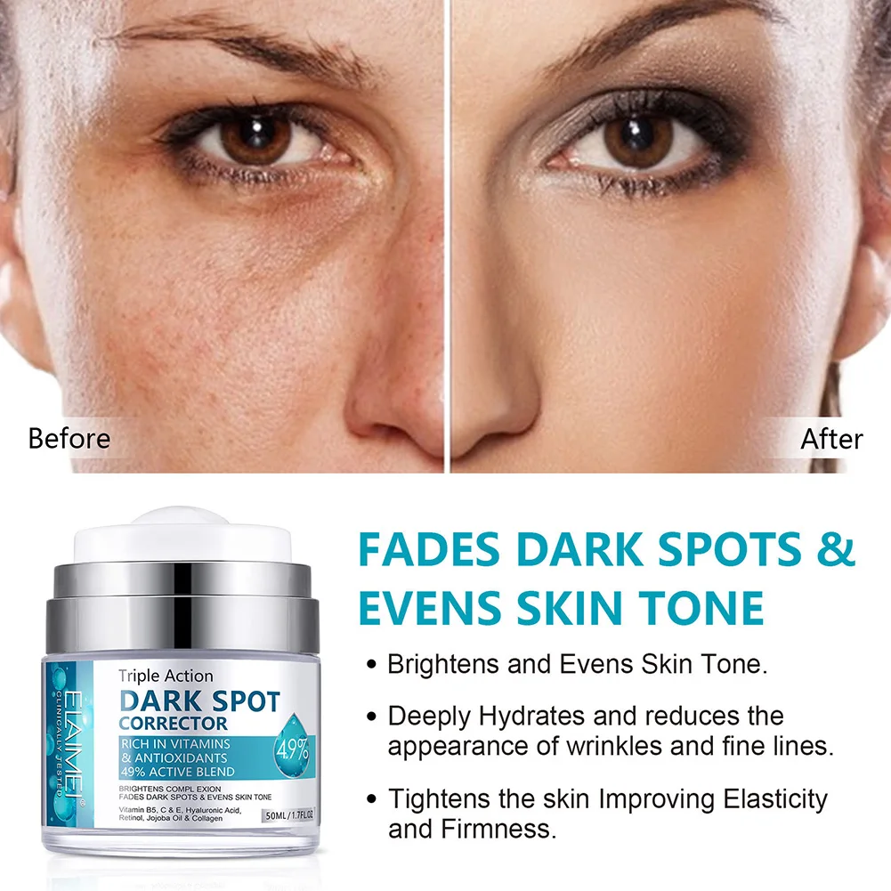 50ml Dark Spot Corrector Cream Anti-Aging Dark Spots Freckles Removal Skin Repair Face Moisturizing Brightening Skin Care Cream
50ml Dark Spot Corrector Cream Anti-Aging Dark Spots Freckles Removal Skin Repair Face Moisturizing Brightening Skin Care Cream