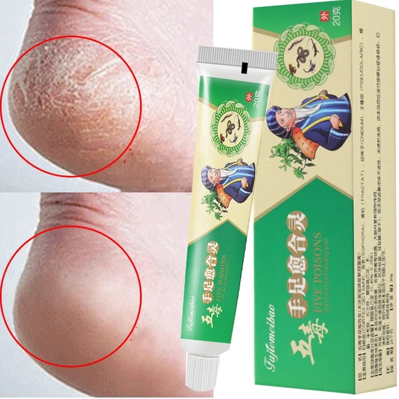 Herb Anti Crack Foot Cream Drynes Foot Mask Heel Cracked Repair Cream Hand Mositurizing Removal Callus Dead Skin Hands Feet Care
Herb Anti Crack Foot Cream Drynes Foot Mask Heel Cracked Repair Cream Hand Mositurizing Removal Callus Dead Skin Hands Feet Care