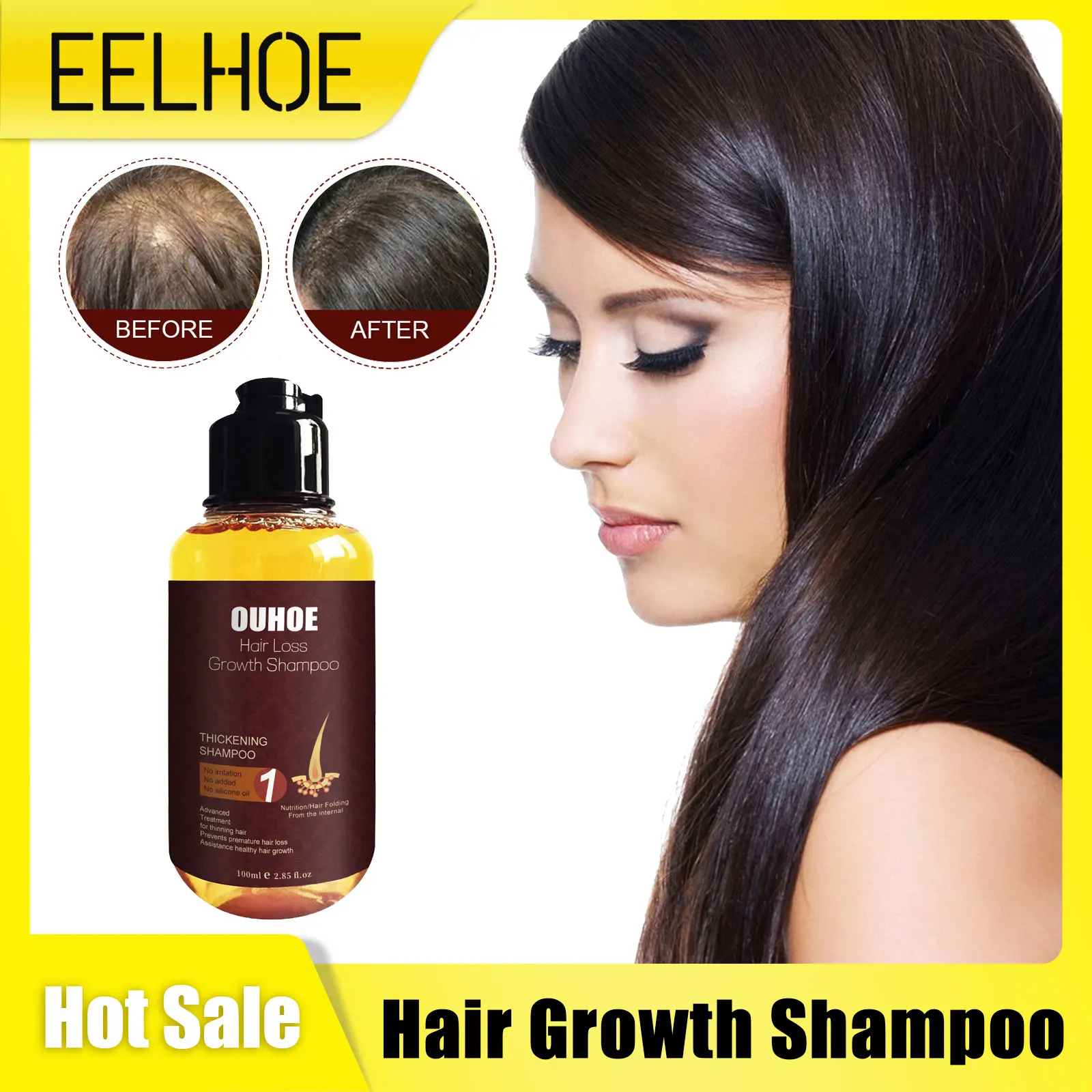 Hair Growth Shampoo Scalp Treatment Deep Cleaning Follicles Prevent Baldness Alopecia Nourishing Thicken Anti Hairs Loss Shampoo
Hair Growth Shampoo Scalp Treatment Deep Cleaning Follicles Prevent Baldness Alopecia Nourishing Thicken Anti Hairs Loss Shampoo