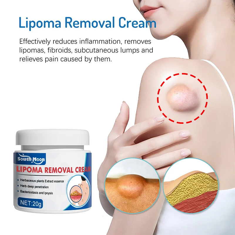 Herbal Essence Fat Caking Removal Cream Swelling Pain Relief Cellulite Lipoma Removal Ointment Moisturizer Korean Cosmetics 20g
Herbal Essence Fat Caking Removal Cream Swelling Pain Relief Cellulite Lipoma Removal Ointment Moisturizer Korean Cosmetics 20g
