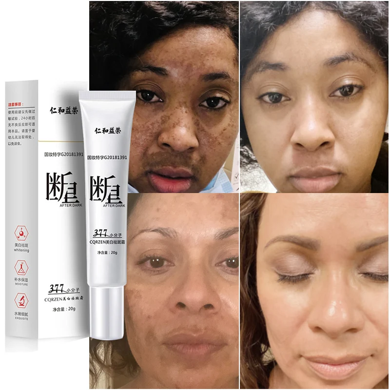Face Skin Care Freckles Cream Melanin Removal Melasma Remover Moisturize Brighten Whitening Remove Melasma Dark Spot Lightening
Face Skin Care Freckles Cream Melanin Removal Melasma Remover Moisturize Brighten Whitening Remove Melasma Dark Spot Lightening