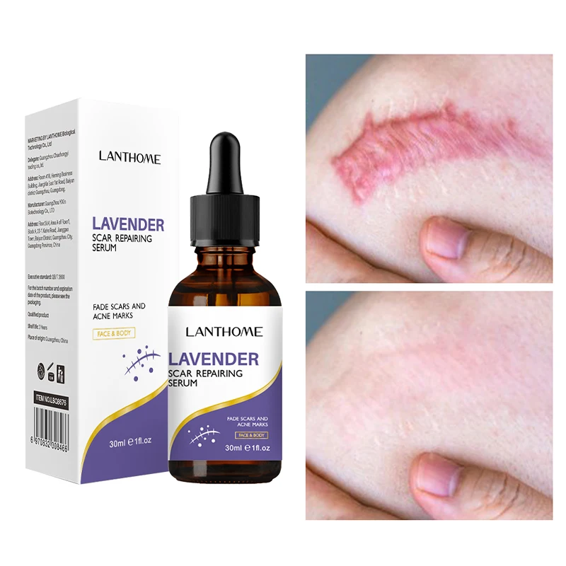 Lavender Scar Repair Serum Herbal Scar Removal Pock Mark Burn Surgical Scar Stretch Mark Repairing Smooth Moisturizing Skin Care
Lavender Scar Repair Serum Herbal Scar Removal Pock Mark Burn Surgical Scar Stretch Mark Repairing Smooth Moisturizing Skin Care