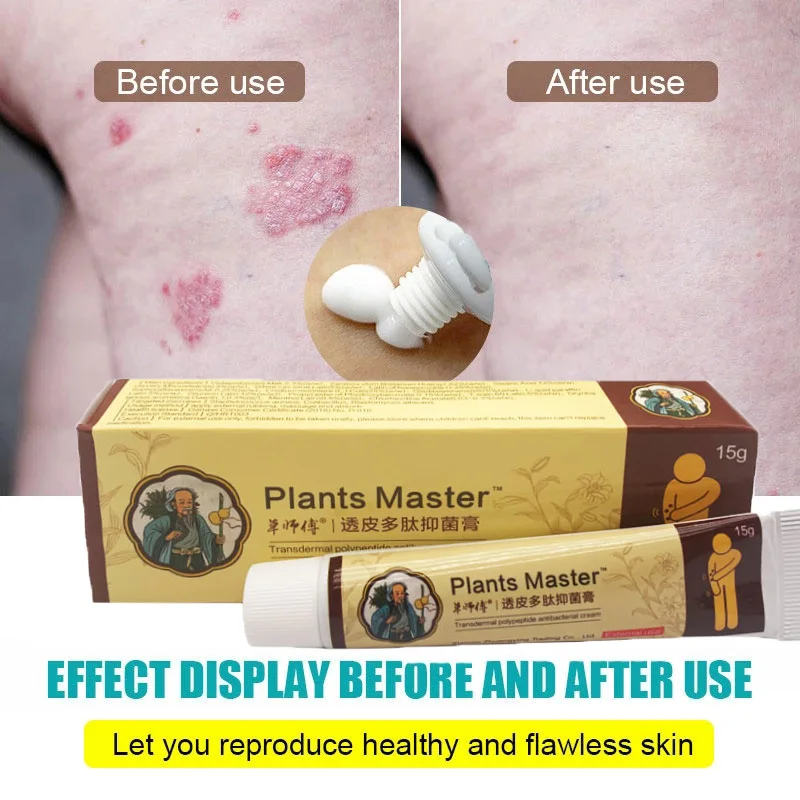 2pcs Traditional Chinese Medicine Psoriasis Ointment Eczema Hand Tinea Foot Odor Inhibit Dermatitis Fungus Antipruritic Cream
2pcs Traditional Chinese Medicine Psoriasis Ointment Eczema Hand Tinea Foot Odor Inhibit Dermatitis Fungus Antipruritic Cream