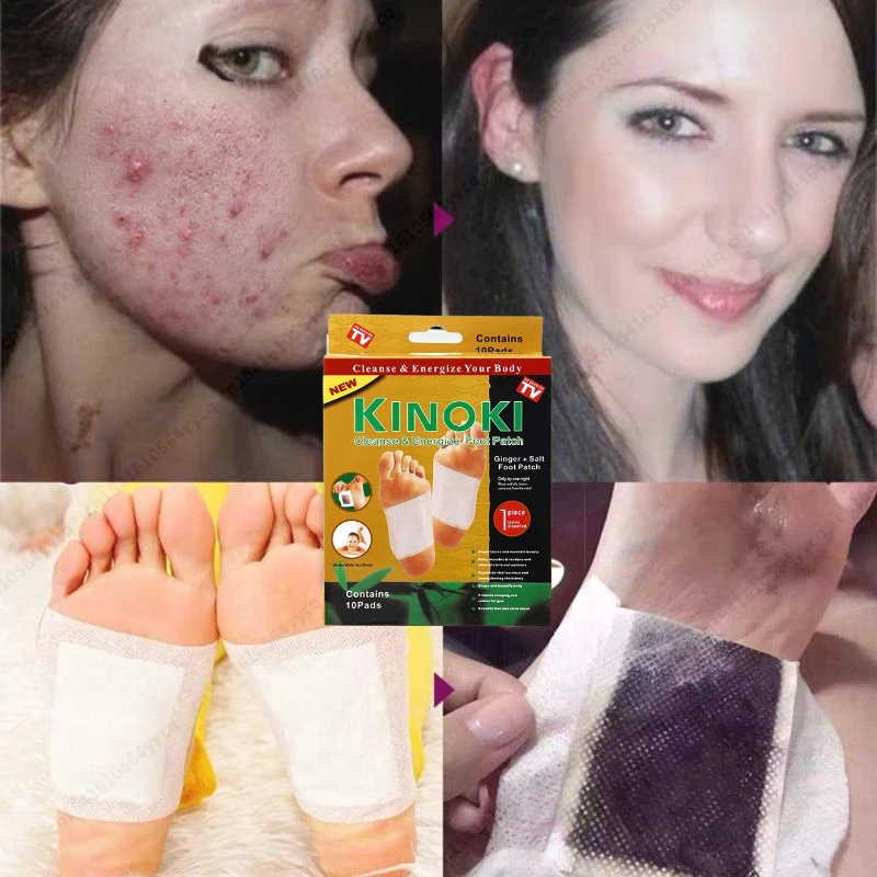 10 pairs/box Detox Foot Patch Tradition Chinese Medicine Wormwood Health Body Detox Improve Sleep Foot Care Patch Dropshipping
10 pairs/box Detox Foot Patch Tradition Chinese Medicine Wormwood Health Body Detox Improve Sleep Foot Care Patch Dropshipping