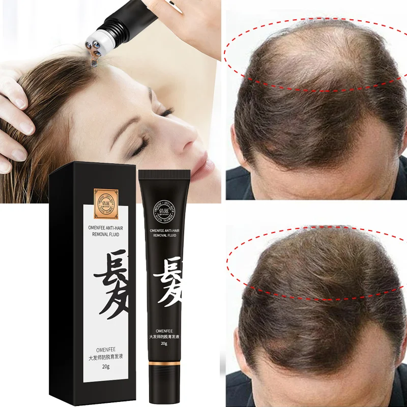 Hair Growth Shampoo Conditioner Thickener Anti Hair Loss Products Grow Hair Regrowth Scalp Treatment Serum Oil Men Women
Hair Growth Shampoo Conditioner Thickener Anti Hair Loss Products Grow Hair Regrowth Scalp Treatment Serum Oil Men Women