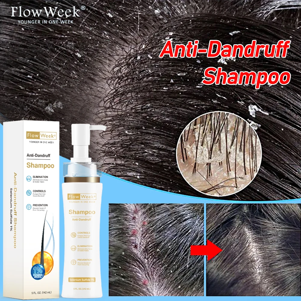 

Шампунь от перхоти FlowWeek, против зуда, лечение морской кожи головы, контроль жирности кожи головы, очищающее средство, антибактериальный Уход за волосами