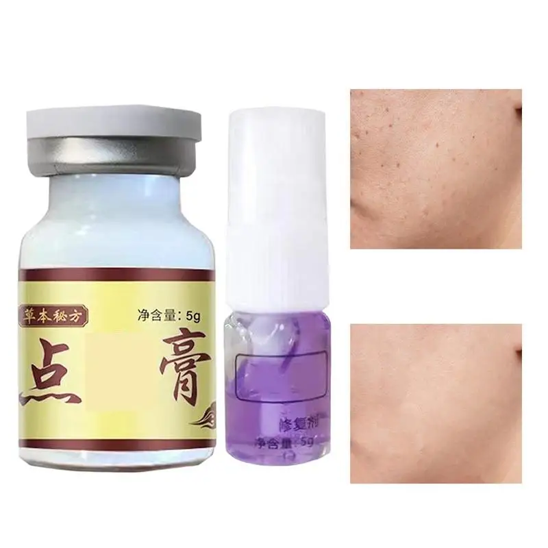 

Lightening Face Cream Freckles Cream Age Spots Removal Skin Care Dark Spots Melasma Lightening Herbal Formula Ointment 5g