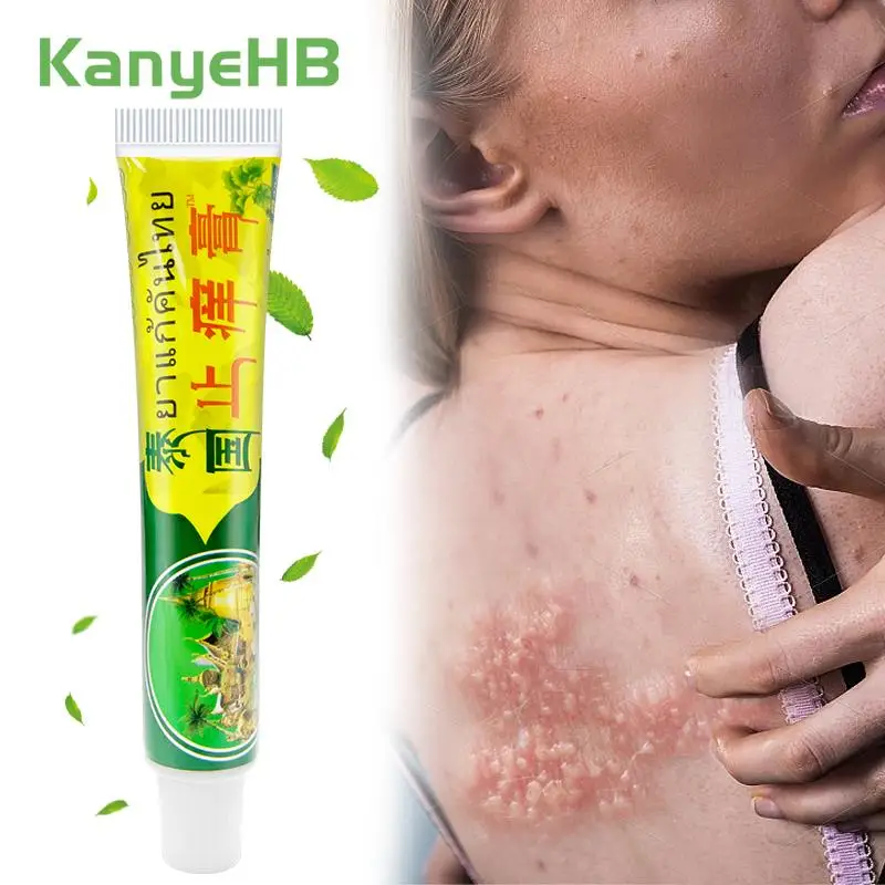 

1Pcs Psoriasis Ointment Rash Dermatitis Eczema Beriberi Treatment Cream Inhibit Fungi Skin Cream Anti-itch Herbal Plaster S074