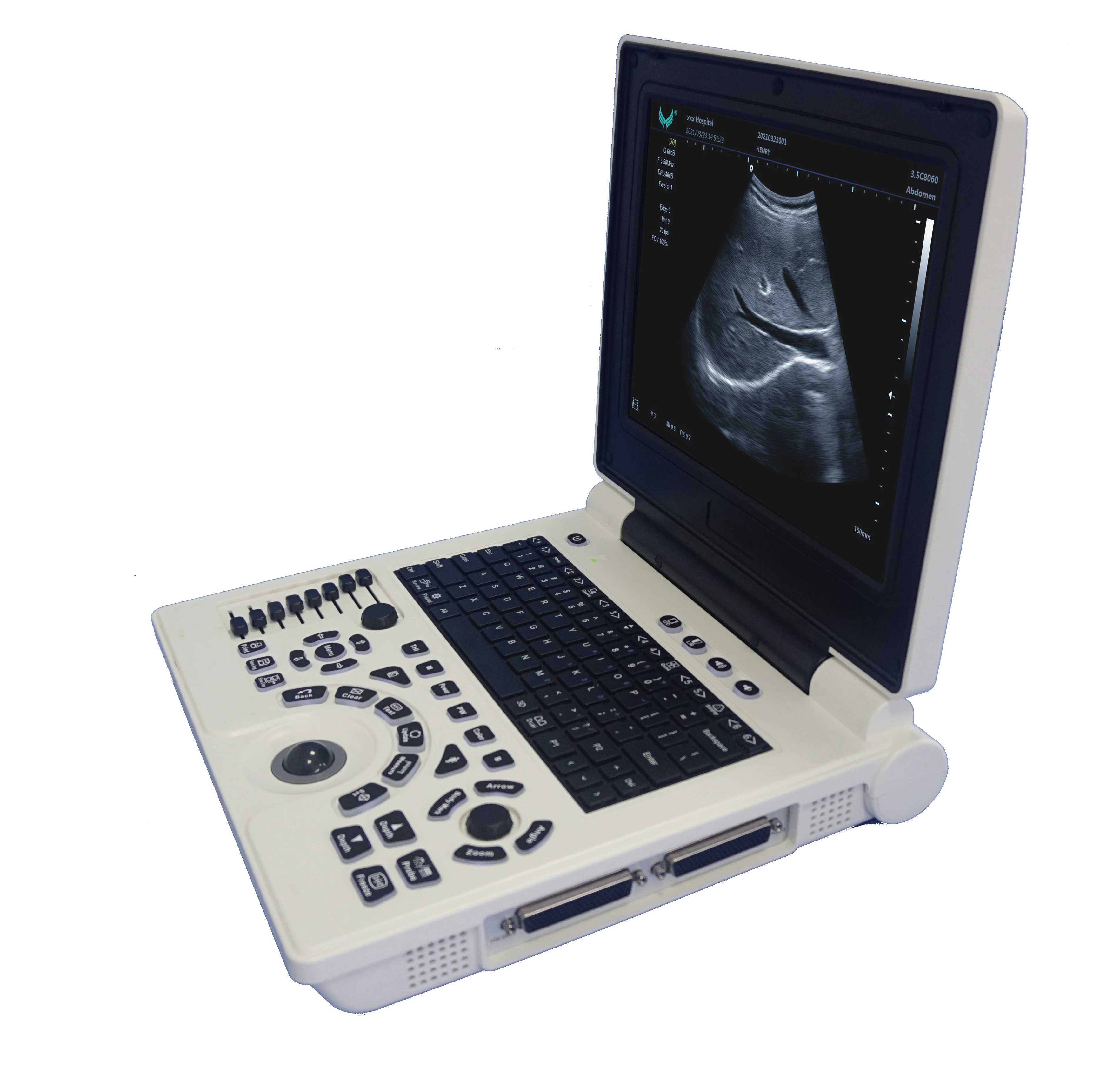 

Cheap BW ultrasound scanner with THI PW 3D for human or Veterinary software optional