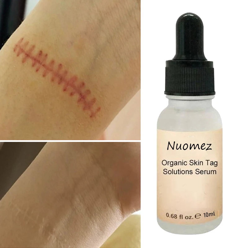 10ml Dragon Blood Essence Original Solution Repair Pit Acne Scar Set Box Care Bump Scar Cream Essence Serum Facial free shipping
10ml Dragon Blood Essence Original Solution Repair Pit Acne Scar Set Box Care Bump Scar Cream Essence Serum Facial free shipping