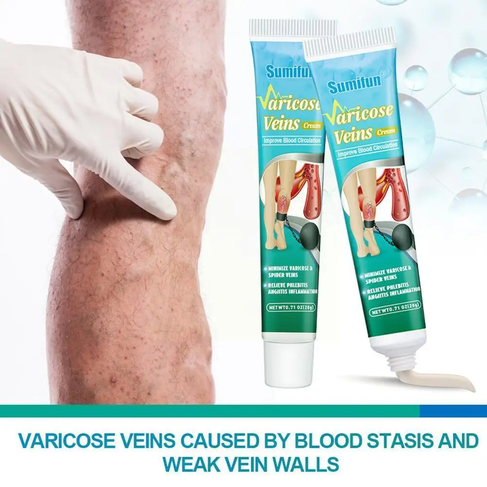 Feet Varicose Veins Cream Treatment Chinese Herbal Medicine For Varicosity Angiitis Removal Phlebitis Leg Veins Pain Ointme X5e7
Feet Varicose Veins Cream Treatment Chinese Herbal Medicine For Varicosity Angiitis Removal Phlebitis Leg Veins Pain Ointme X5e7