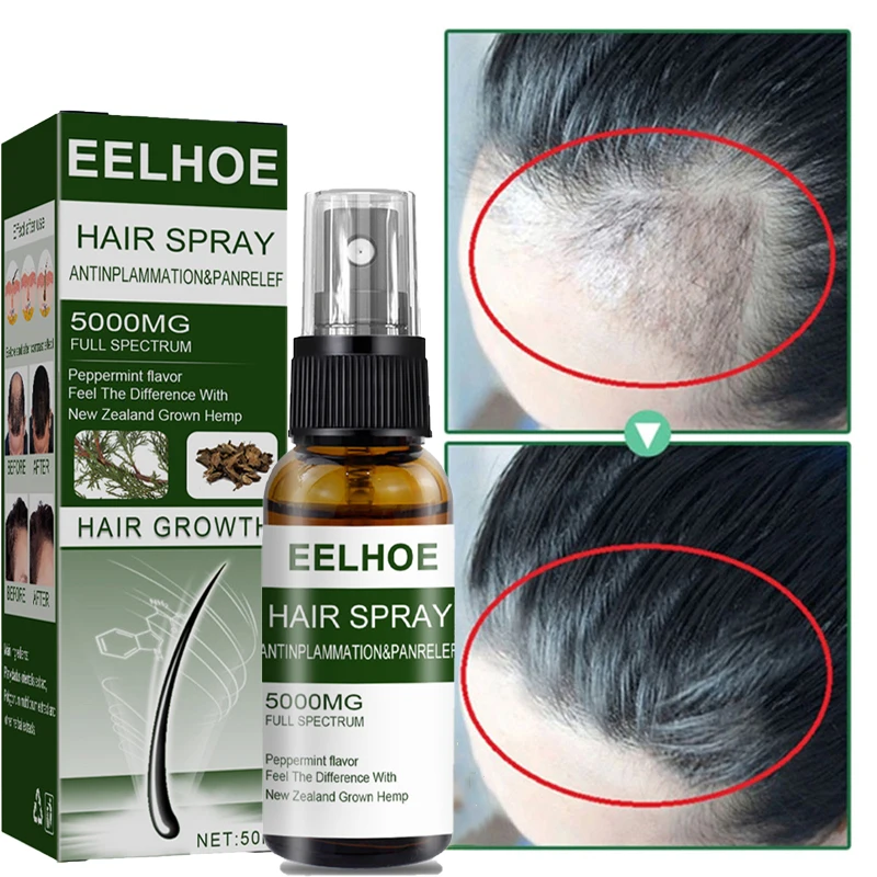 Hair Growth Products Fast Growing Anti Hair Loss Spray Serum Hair Thinning Treatment Repair Nourish Damaged Hair Care 50ml
Hair Growth Products Fast Growing Anti Hair Loss Spray Serum Hair Thinning Treatment Repair Nourish Damaged Hair Care 50ml